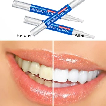 1 stk Magic Naturlige Tænder Whitening Gel Pen Rengøring Fjerne Pletter Pleje Værktøjer Tand mundhygiejne Tandblegning Pen