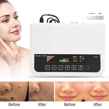 Ultralyd Facial Hud Foryngelse Skønhed Maskine Fregner Pigment Alder Pletter Remover Tatoveringer Hudorm Vakuum Pore Renere Acne